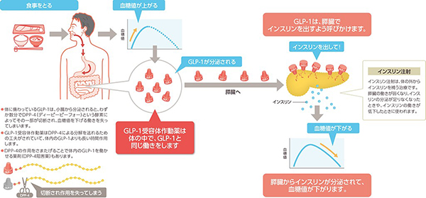 糖尿病の治療法 角田医院分院 佐久市岩村田の内科 小児科 呼吸器内科 糖尿病内科 アレルギー科